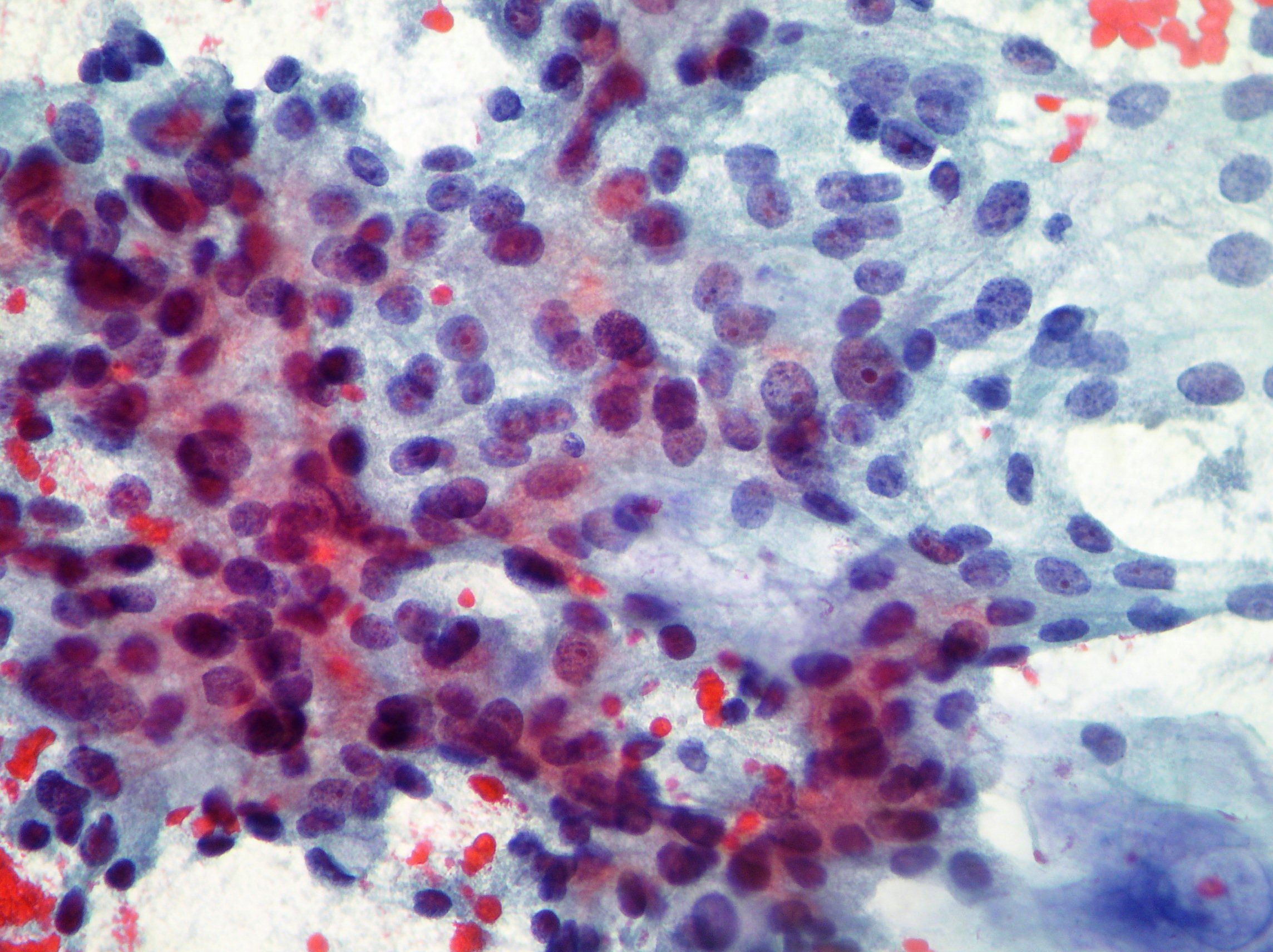 Breast Cytopathology